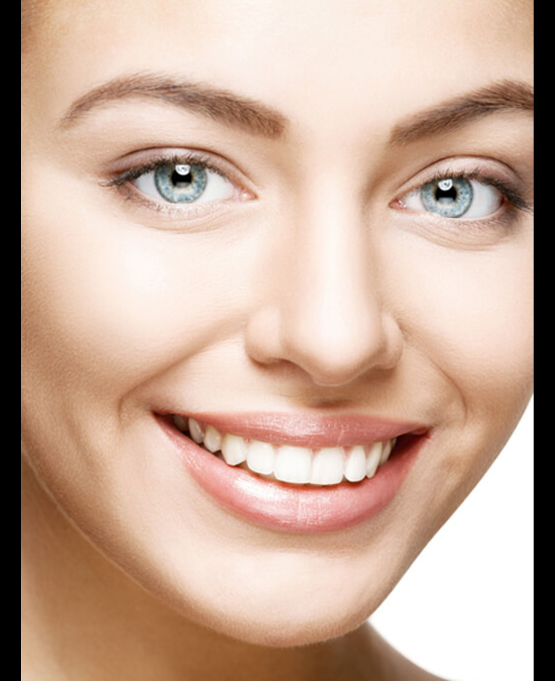 Teeth Whitening